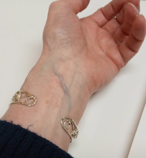 Judy Larson's Putting On and Taking Off a Cuff Bracelet - , General Education, , Continue to push the cuff around the wrist